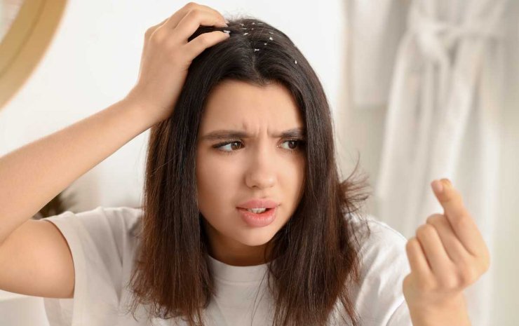 Quali segnali ci fanno capire di avere i capelli sporchi